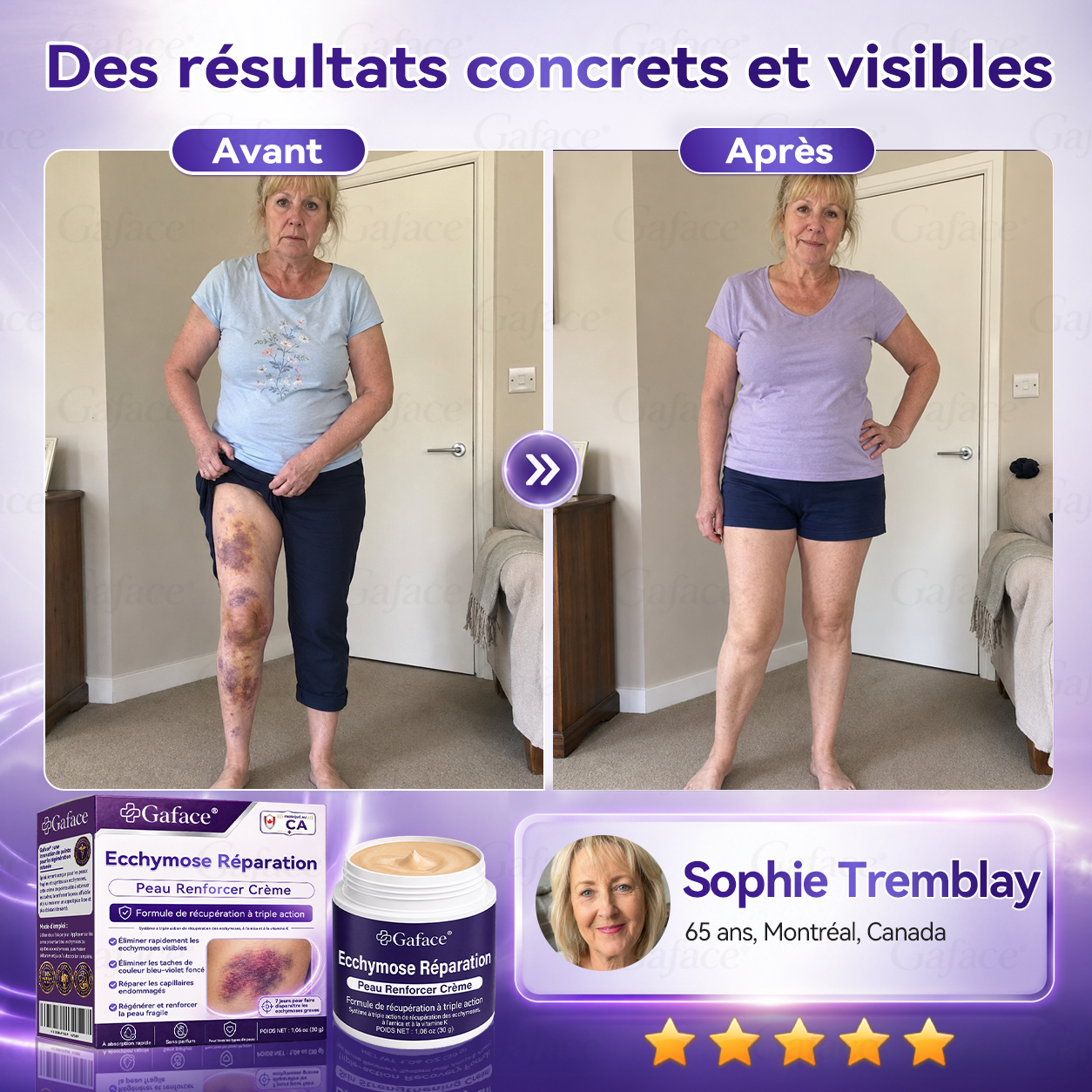 【110 𝒌+ 𝒗𝒆𝒏𝒅𝒖𝒔】✨ 𝑮𝒂𝒇𝒂𝒄𝒆® 𝑪𝒓è𝒎𝒆 𝒓é𝒑𝒂𝒓𝒂𝒕𝒓𝒊𝒄𝒆 𝒅𝒆𝒔 𝒆𝒄𝒄𝒉𝒚𝒎𝒐𝒔𝒆𝒔 𝒆𝒕 𝒇𝒐𝒓𝒕𝒊𝒇𝒊𝒂𝒏𝒕𝒆 𝒑𝒐𝒖𝒓 𝒍𝒂 𝒑𝒆𝒂𝒖