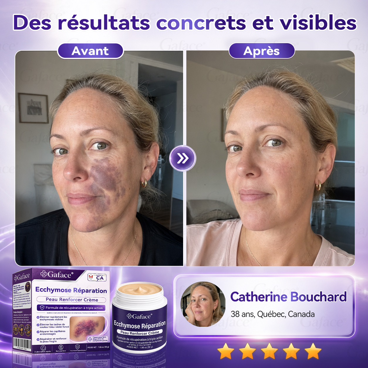 【110 𝒌+ 𝒗𝒆𝒏𝒅𝒖𝒔】✨ 𝑮𝒂𝒇𝒂𝒄𝒆® 𝑪𝒓è𝒎𝒆 𝒓é𝒑𝒂𝒓𝒂𝒕𝒓𝒊𝒄𝒆 𝒅𝒆𝒔 𝒆𝒄𝒄𝒉𝒚𝒎𝒐𝒔𝒆𝒔 𝒆𝒕 𝒇𝒐𝒓𝒕𝒊𝒇𝒊𝒂𝒏𝒕𝒆 𝒑𝒐𝒖𝒓 𝒍𝒂 𝒑𝒆𝒂𝒖