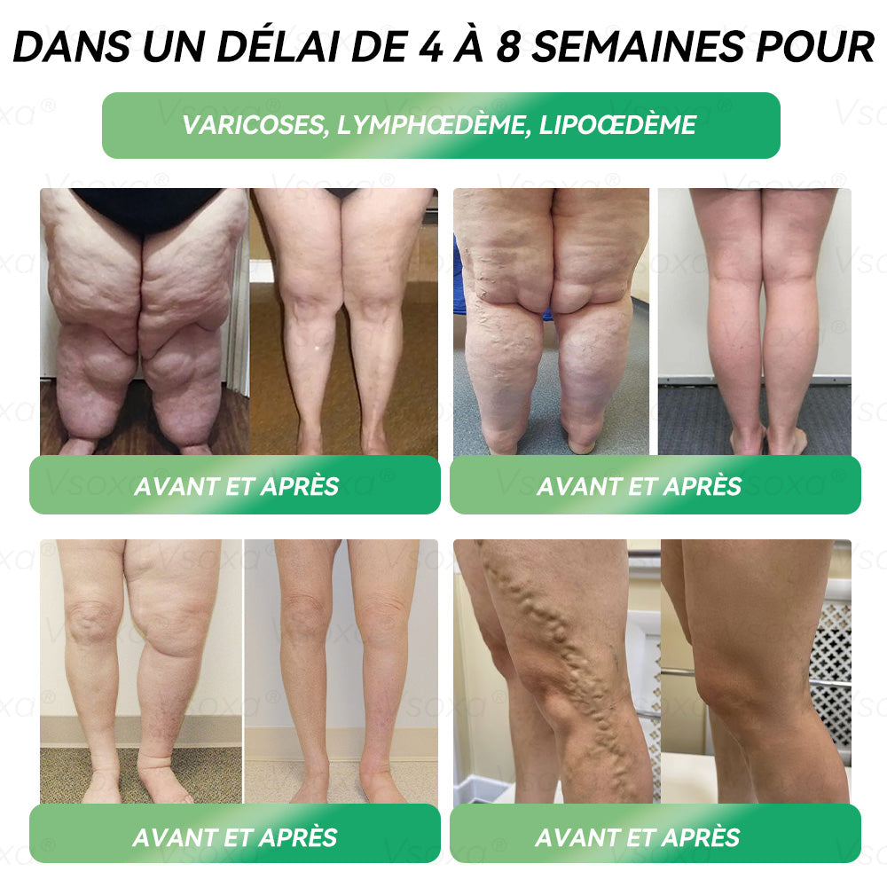 𝑅é𝑑𝑢𝑐𝑡𝑖𝑜𝑛 𝑑𝑒 30 % 𝑝𝑜𝑢𝑟 𝑢𝑛𝑒 𝑑𝑢𝑟é𝑒 𝑙𝑖𝑚𝑖𝑡é𝑒 ⏰ 𝑉𝑠𝑜𝑥𝑎® 𝐺𝐿𝑃-1 𝑀𝑖𝑐𝑟𝑜𝑐𝑎𝑝𝑠𝑢𝑙𝑒 É𝑐𝑙𝑎𝑡𝑒𝑚𝑒𝑛𝑡 𝑃𝑎𝑡𝑐ℎ 👍👍👍