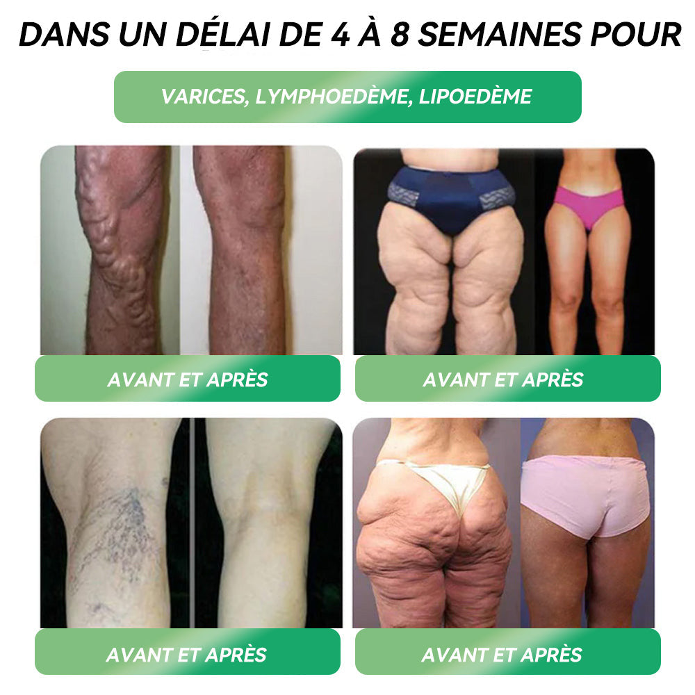 𝑅é𝑑𝑢𝑐𝑡𝑖𝑜𝑛 𝑑𝑒 30 % 𝑝𝑜𝑢𝑟 𝑢𝑛𝑒 𝑑𝑢𝑟é𝑒 𝑙𝑖𝑚𝑖𝑡é𝑒 ⏰ 𝑆𝑇𝐷𝐸𝐼®𝐺𝐿𝑃-1 𝑃𝑜𝑖𝑑𝑠 𝑃𝑒𝑟𝑡𝑒 𝑂𝑟𝑎𝑙 𝑆𝑜𝑙𝑢𝑡𝑖𝑜𝑛