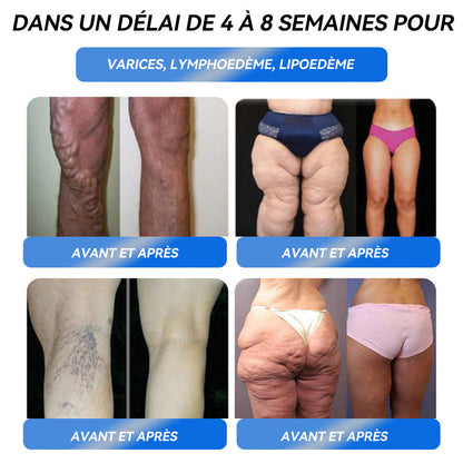 Remise limitée de 30 %⏰ 𝐈𝐅𝐌𝐀𝐆𝐈𝐂® 𝐆𝐋𝐏-𝟏 𝐏𝐫𝐨 𝐒𝐨𝐥𝐮𝐭𝐢𝐨𝐧 𝐨𝐫𝐚𝐥𝐞 𝐩𝐨𝐮𝐫 𝐥𝐚 𝐩𝐞𝐫𝐭𝐞 𝐝𝐞 𝐩𝐨𝐢𝐝𝐬👍👍👍