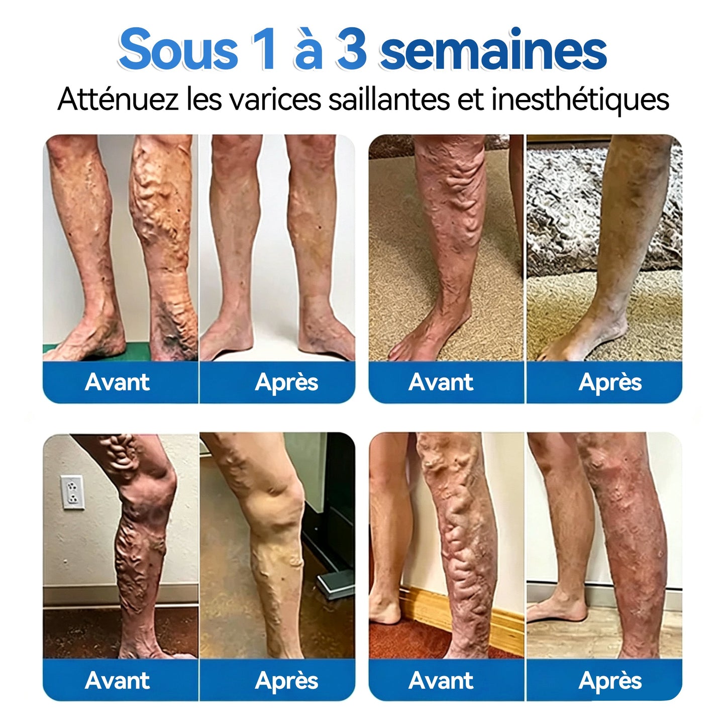 ✅️🏃𝐅𝐥𝐨𝐫𝐢𝐬𝐦𝐚®🌼💖𝐑é𝐩𝐚𝐫𝐚𝐭𝐢𝐨𝐧 𝐃𝐞𝐬 𝐕𝐞𝐢𝐧𝐞𝐬 𝐑𝐨𝐮𝐥𝐞𝐚𝐮 𝐃𝐞 𝐏𝐚𝐭𝐜𝐡𝐬 𝐀𝐯𝐞𝐜 𝐌𝐢𝐜𝐫𝐨-𝐚𝐢𝐠𝐮𝐢𝐥𝐥𝐞𝐬⚡Soulagement immédiat, résultats à long terme