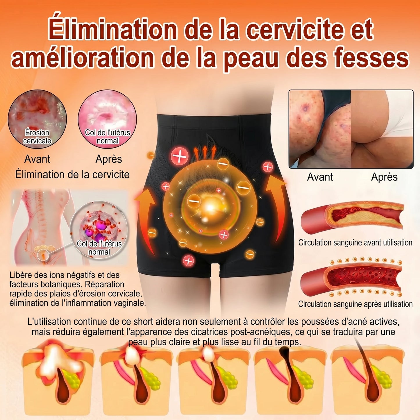 💖𝐏𝐀𝐔𝐑𝐀𝐉𝐔® 𝐌𝐨𝐫𝐢𝐧𝐠𝐚 𝐄𝐭 𝐁𝐞𝐫𝐛é𝐫𝐢𝐧𝐞 𝐓𝐨𝐮𝐭-𝐄𝐧-𝐔𝐧 𝐒𝐡𝐨𝐫𝐭𝐬 𝐁𝐫û𝐥𝐞-𝐆𝐫𝐚𝐢𝐬𝐬𝐞 À 𝐌𝐢𝐜𝐫𝐨𝐩𝐚𝐫𝐭𝐢𝐜𝐮𝐥𝐞𝐬✅Active la microcirculation profonde pour faire fondre les graisses, éliminer les toxines et inverser le vieillissement métabolique.