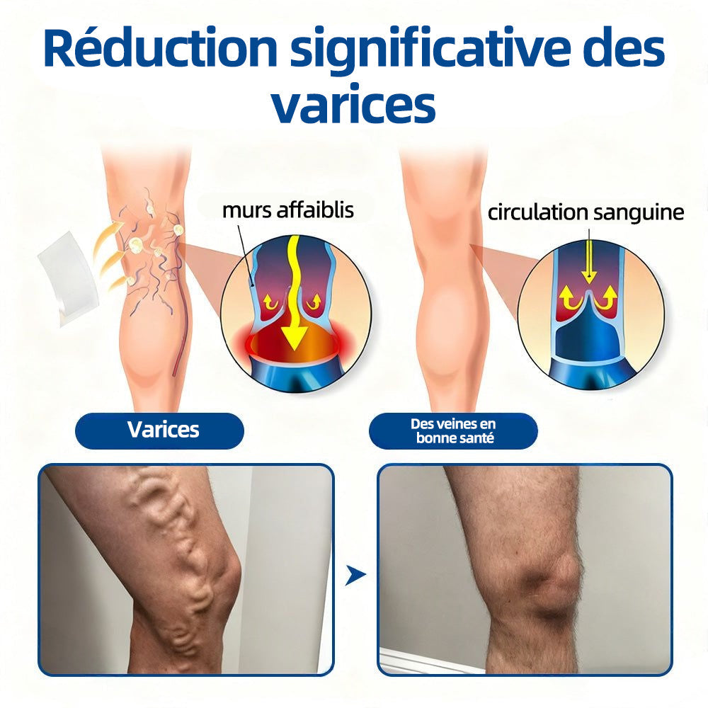 ✅𝐅𝐥𝐨𝐫𝐢𝐬𝐦𝐚®𝐂𝐢𝐛𝐥𝐞 𝐕𝐞𝐢𝐧𝐞𝐮𝐬𝐞 𝐏𝐚𝐭𝐜𝐡 À 𝐌𝐢𝐜𝐫𝐨-𝐀𝐢𝐠𝐮𝐢𝐥𝐥𝐞𝐬⚡Soulagement immédiat, résultats durables (UPSELL)