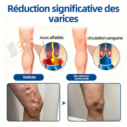 ✅𝐅𝐥𝐨𝐫𝐢𝐬𝐦𝐚®𝐂𝐢𝐛𝐥𝐞 𝐕𝐞𝐢𝐧𝐞𝐮𝐬𝐞 𝐏𝐚𝐭𝐜𝐡 À 𝐌𝐢𝐜𝐫𝐨-𝐀𝐢𝐠𝐮𝐢𝐥𝐥𝐞𝐬⚡Soulagement immédiat, résultats durables (UPSELL)