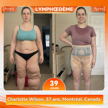 💖𝐏𝐀𝐔𝐑𝐀𝐉𝐔® 𝐌𝐨𝐫𝐢𝐧𝐠𝐚 𝐄𝐭 𝐁𝐞𝐫𝐛é𝐫𝐢𝐧𝐞 𝐓𝐨𝐮𝐭-𝐄𝐧-𝐔𝐧 𝐒𝐡𝐨𝐫𝐭𝐬 𝐁𝐫û𝐥𝐞-𝐆𝐫𝐚𝐢𝐬𝐬𝐞 À 𝐌𝐢𝐜𝐫𝐨𝐩𝐚𝐫𝐭𝐢𝐜𝐮𝐥𝐞𝐬✅Active la microcirculation profonde pour faire fondre les graisses, éliminer les toxines et inverser le vieillissement métabolique.