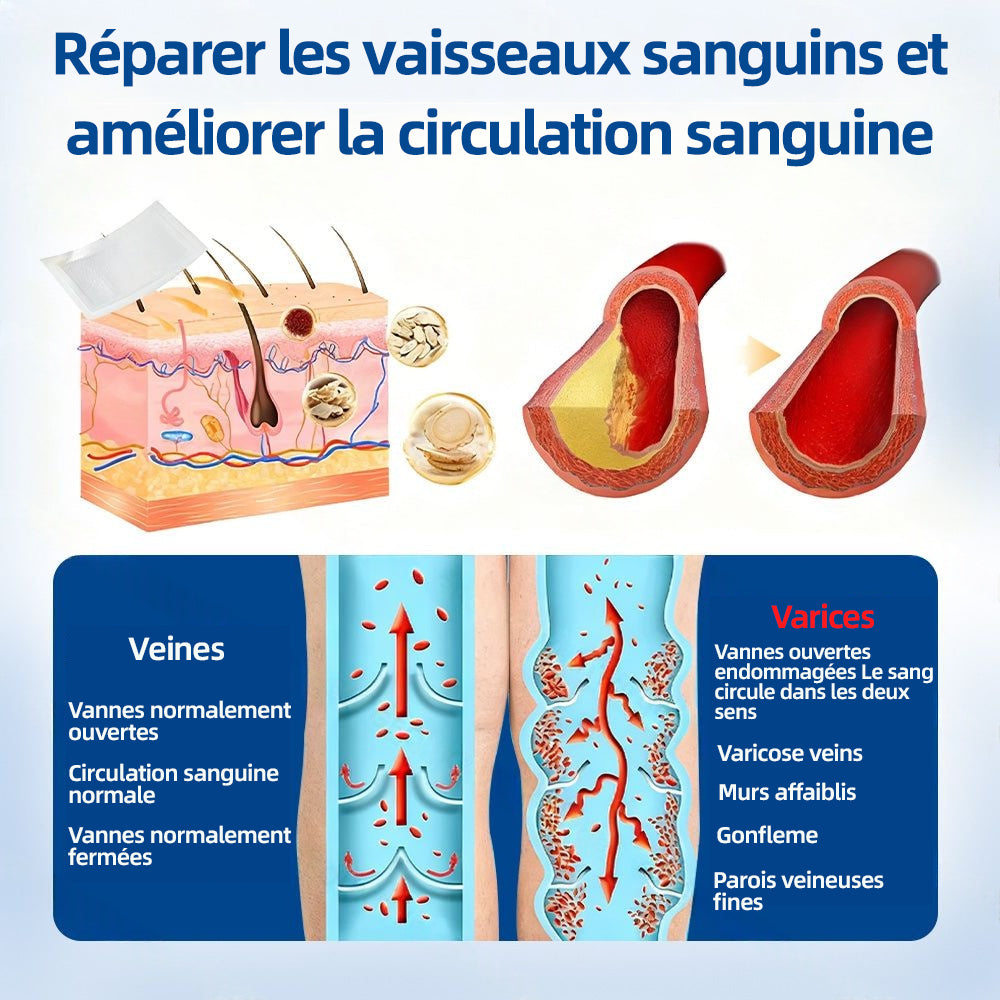 ✅𝐅𝐥𝐨𝐫𝐢𝐬𝐦𝐚®𝐂𝐢𝐛𝐥𝐞 𝐕𝐞𝐢𝐧𝐞𝐮𝐬𝐞 𝐏𝐚𝐭𝐜𝐡 À 𝐌𝐢𝐜𝐫𝐨-𝐀𝐢𝐠𝐮𝐢𝐥𝐥𝐞𝐬⚡Soulagement immédiat, résultats durables (UPSELL)